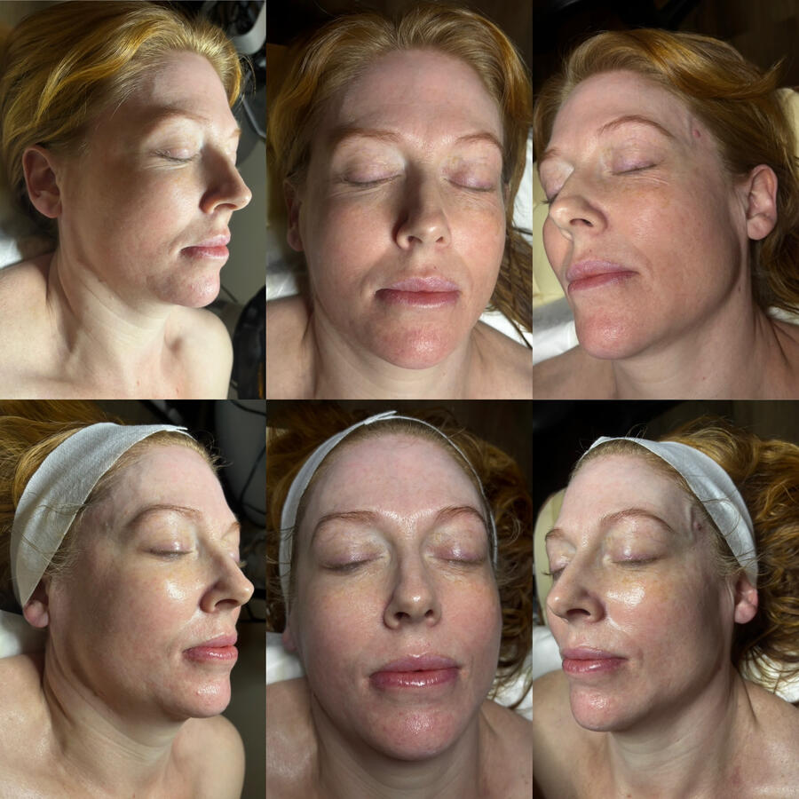 Before (top) + After (bottom)