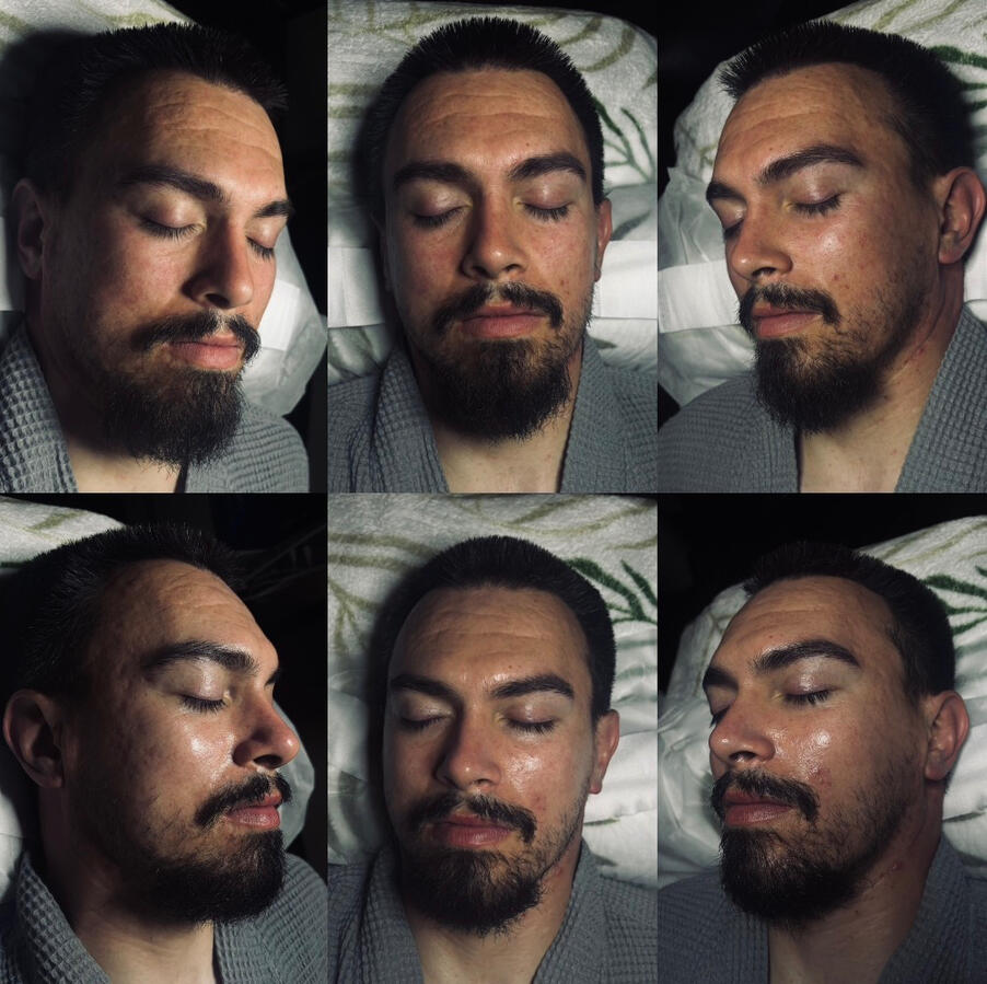 Before (top) + After (bottom)